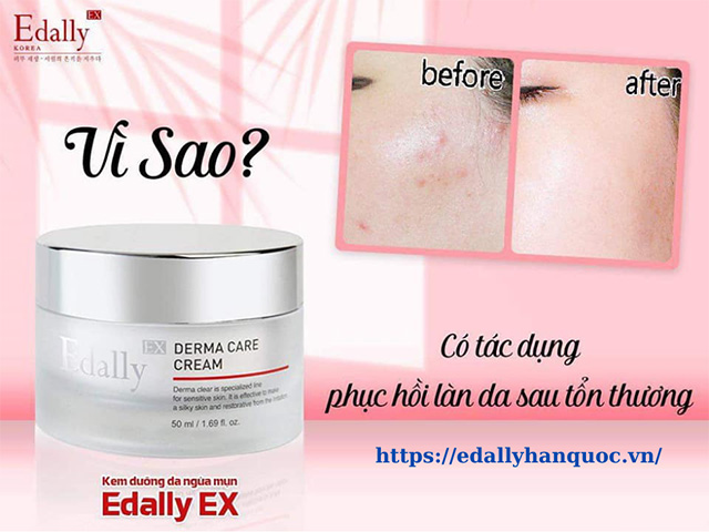 Vì sao Kem dưỡng da trị mụn Edally EX Hàn Quốc có tác dụng phục hồi da sau tổn thương?
