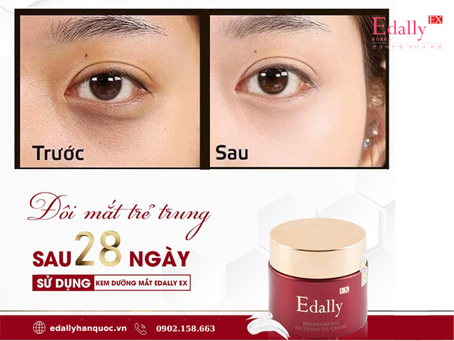 Sản phẩm khuyên dùng cho bước dưỡng da vùng mắt trong quy trình chăm sóc da mặt tại nhà