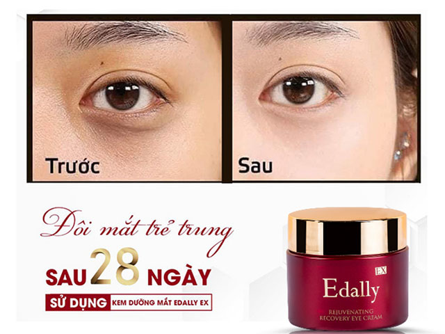 Kem dưỡng mắt Edally EX Hàn Quốc nhập khẩu chính hãng