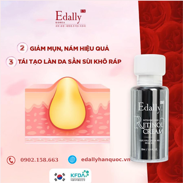 Kem Retoinol Edally EX Hàn Quốc giúp giảm mụn nám và tái tạo làn da sần sủi khô táp hiệu quả