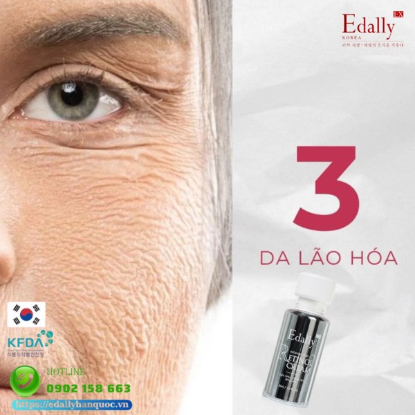 Kem Retinol Edally EX Hàn Quốc có thể dẹp bỏ làn da lão hóa già nua