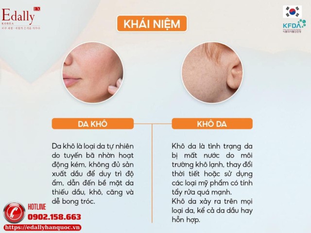 Khái niệm da khô và khô da