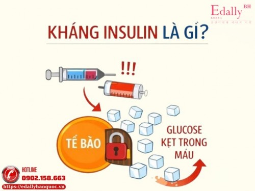  Kháng Insulin là Gì Và Vì Sao Người Bệnh Tiểu Đường Mãi Không Khỏi?