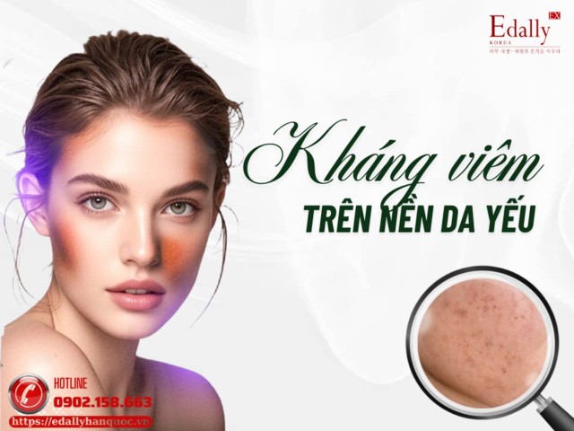 Kháng Viêm Trên Nền Da Nhạy Cảm - Da Yếu Như Thế Nào?