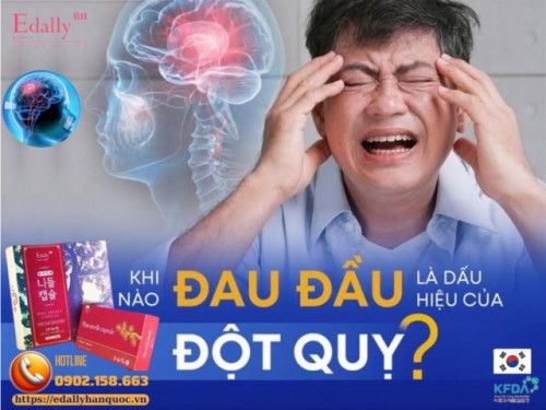 Khi Nào Đau Đầu Là Dấu Hiệu Của Đột Quỵ? 