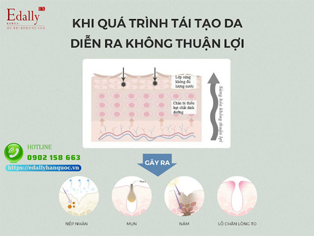 Khi quá trình tái tạo da diễn ra không thuận lợi sẽ như thế nào?