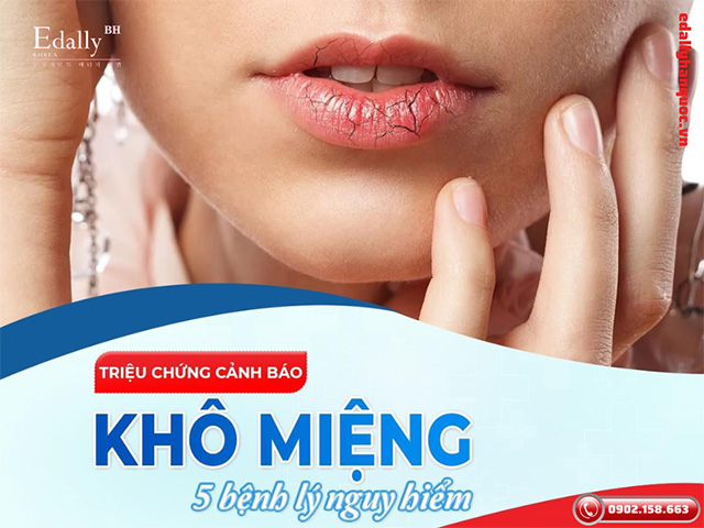 Khô miệng là dấu hiệu cảnh báo 5 bệnh lý nguy hiểm