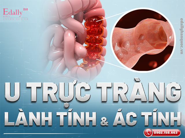 Khối u trực tràng lành tính và ác tính khác nhau ở điểm nào?