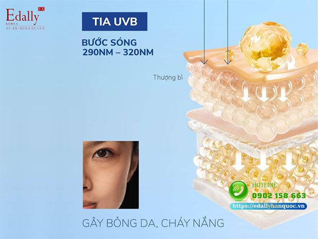 Không chống nắng thường xuyên sẽ khiến da bị bỏng và cháy nắng