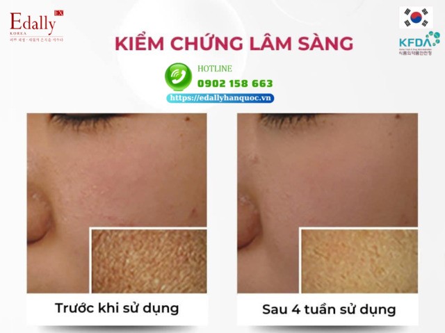 Kết quả lâm sàng về hiệu quảcủa ceramide trong bảo vệ da và da bị bệnh