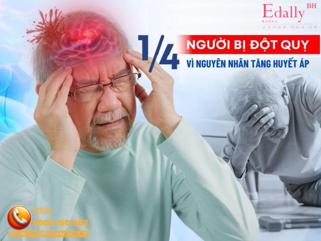 Kiểm soát huyết áp để phòng ngừa tai biến mạch máu não Kiểm soát huyết áp để phòng ngừa tai biến mạch máu não