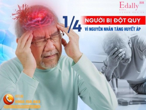 Kiểm Soát Huyết Áp Để Phòng Ngừa Tai Biến Mạch Máu Não