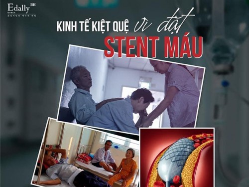 Kiệt Quệ Kinh Tế Vì Đặt Stent Máu Mạch Vành