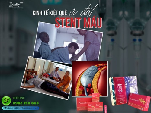 Đặt Stent Tim Là Gì Và Làm Sao Để Không Phải Đặt Stent Tim?