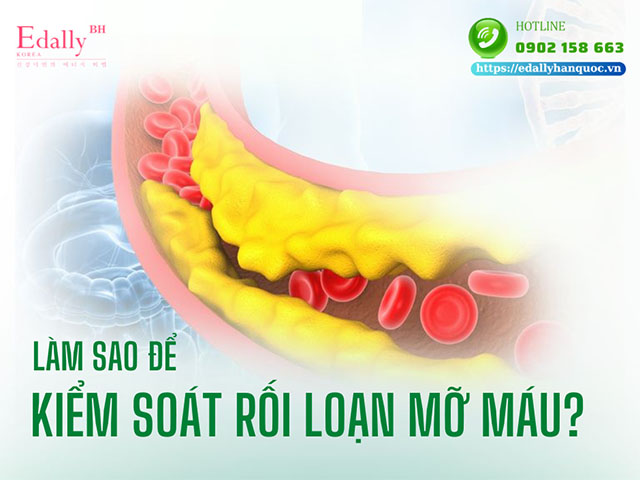 Làm sao để kiểm soát rối loạn mỡ máu hiệu quả?