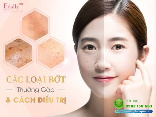 Làm Sao Để Loại Bỏ Bớt Sắc Tố?