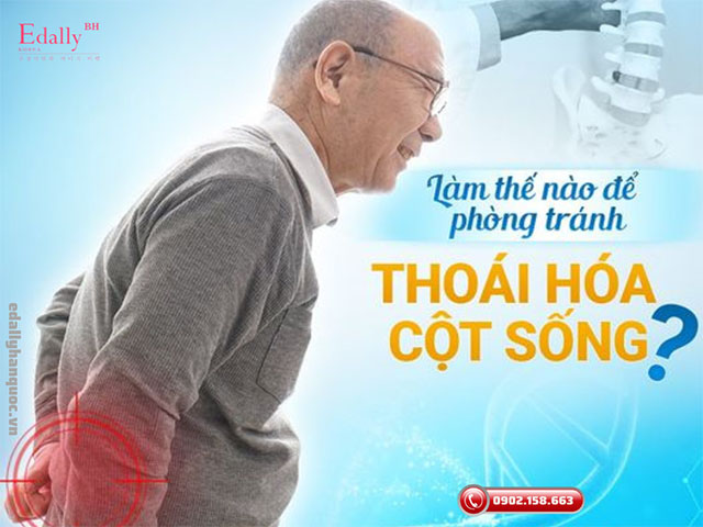 Làm thế nào để phòng ngừa sớm bệnh thoái hóa cột sống