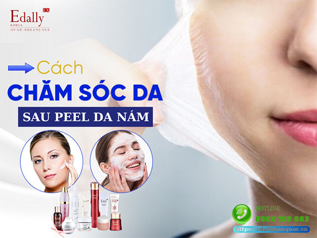 Làm sao để tăng cường hiệu quả cải thiện nám sau peel da?