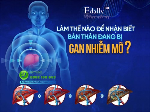 Đảo Ngược Gan Nhiễm Mỡ Bằng Cách Nào?