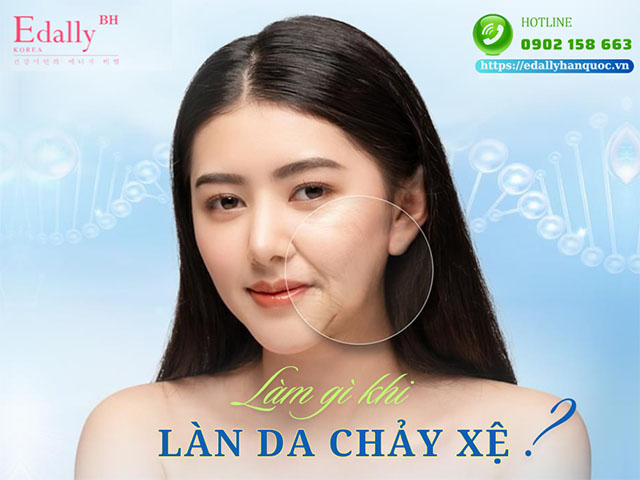 Làm thế nào để cải thiện làn da bị chảy xệ?