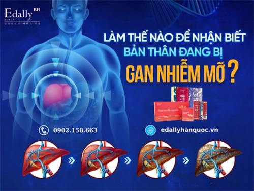 Làm Thế Nào Để Nhận Biết Bản Thân Đang Bị Gan Nhiễm Mỡ?