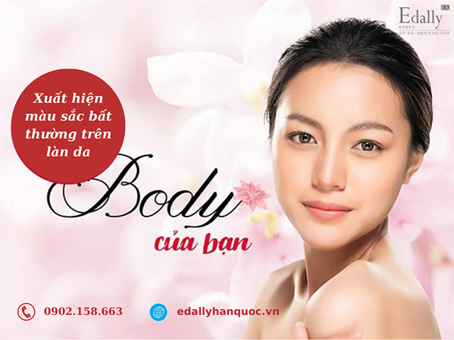 Làn da Body xuất hiện màu sắc bất thường tại các vị trí khác nhau