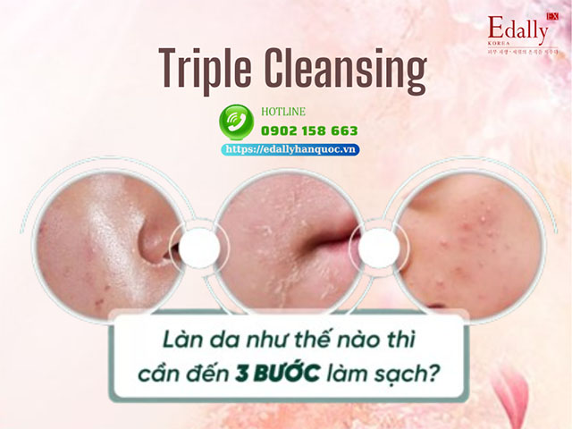 Làn da như thế nào thì phải dùng đến phương pháp Triple Cleansing?