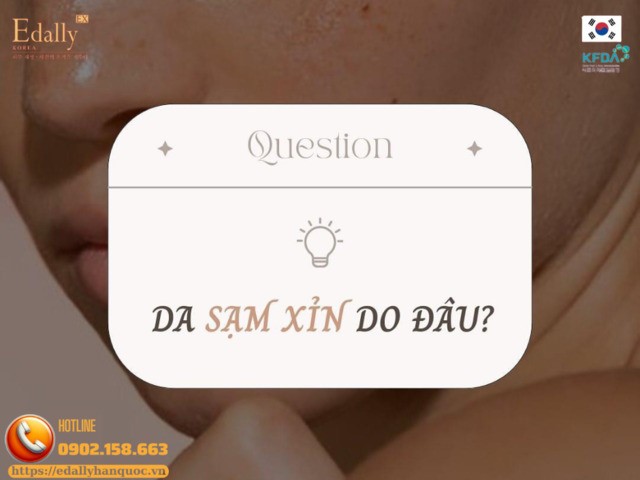 Da xỉn màu là do đâu?