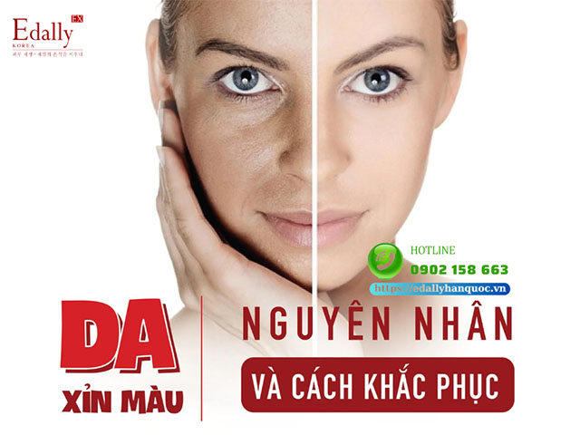 Cách Khắc Phục Làn Da Xỉn Màu, Thiếu Sức Sống