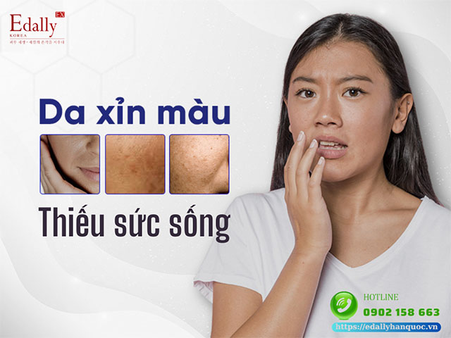 Cách khắc phục làn da xỉn màu, thiếu sức sống như thế nào?