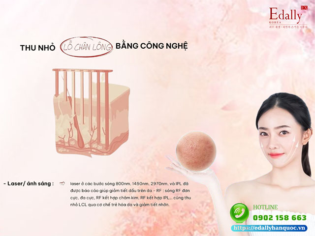 Cách thu nhỏ lỗ chân lông bằng công nghệ Laser/ ánh sáng