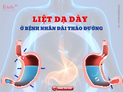 Biến Chứng Liệt Dạ Dày Ở Bệnh Nhân Đái Tháo Đường