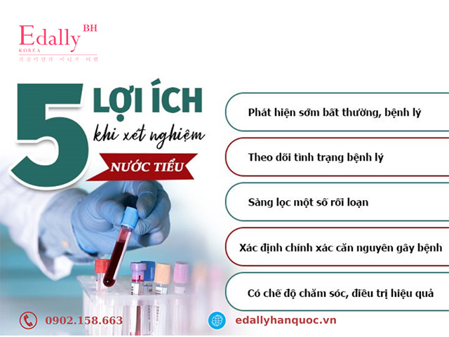 Tại sao cần phải xét nghiệm nước tiểu?