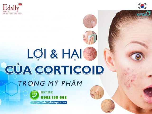 Lợi và hại của Corticoid trong mỹ phẩm