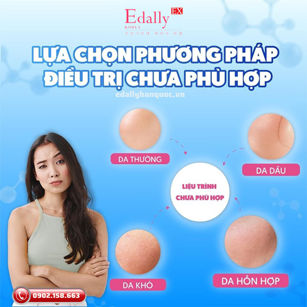 Điều trị nám mãi không hết do lựa chọn phương pháp điều trị chưa phù hợp