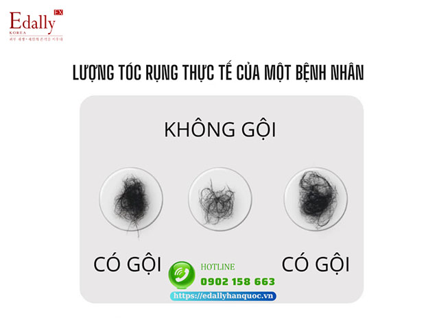 Lượng tóc rụng thực tế của 1 người khi gội đầu và không gội đầu