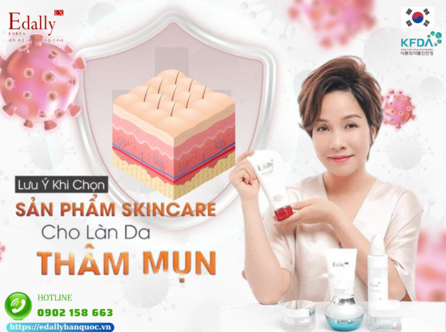 Khi chọn sản phẩm skincare cho làn da thâm mụn cần lưu ý những gì?