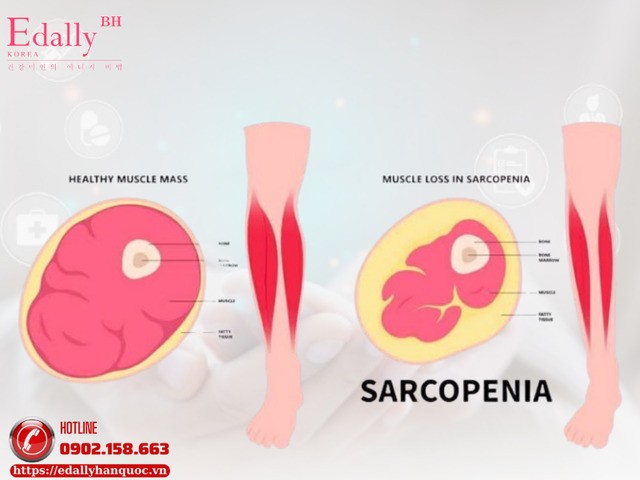 Lý do tại sao bạn không ăn gì vẫn béo