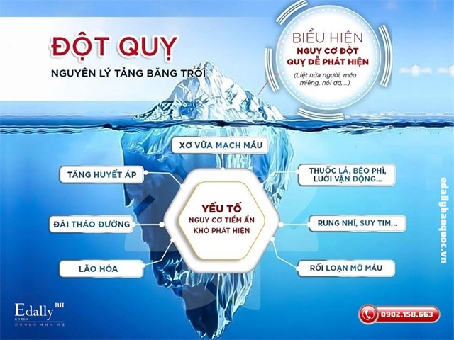 Lý do chúng ta phải chủ động tầm soát và phòng chống đột quỵ