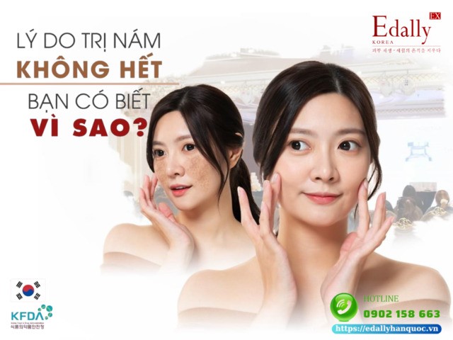 Lý do khiến phụ nữ thất bại trong việc trị nám da?