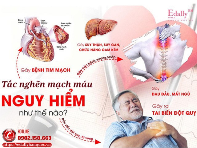 Mạch máu người tiểu đường bị tắc nghẽn nguy hiểm như thế nào?