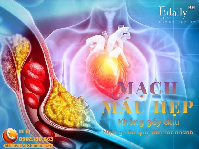 Những Dấu Hiệu Cho Thấy Mạch Máu Có Thể Đang Bị Hẹp