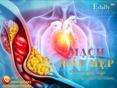 Những Dấu Hiệu Cho Thấy Mạch Máu Có Thể Đang Bị Hẹp