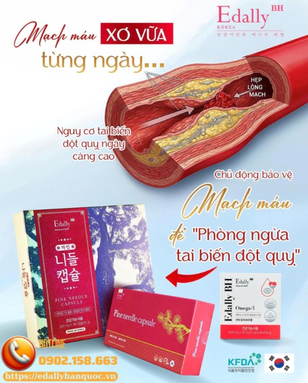 Mạch máu xơ vữa từng ngày làm nguy cơ tai biến, đột quỵ ngàng càng cao