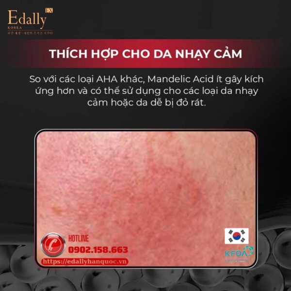 Mandelic Acid là loại AHA phù hợp cho làn da nhạy cảm