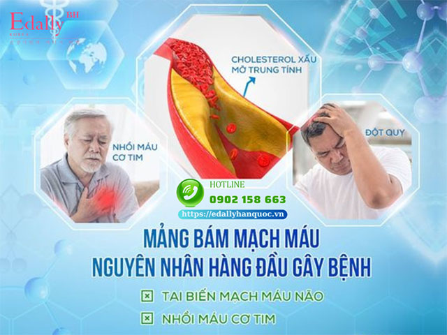 Mỡ máu xấu gây nên các mảng bám ở động mạch vành là nguyên nhân chính gây nên đau thắt ngực và nhồi máu cơ tim