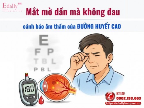 Mắt Mờ Dần Mà Không Đau - Cảnh Báo Âm Thầm Của Đường Huyết Cao