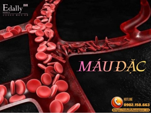 Máu Đặc - Dấu Hiệu Nhận Biết Và Cách Phòng Ngừa Hiệu Quả