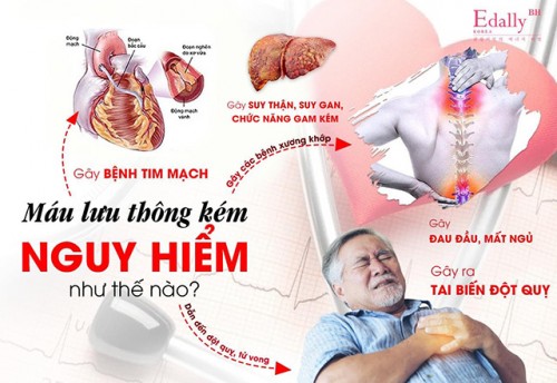 Máu Lưu Thông Kém Nguy Hiểm Thế Nào?