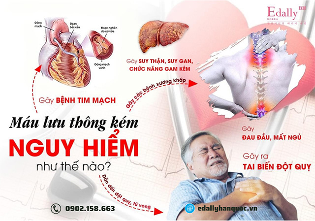 Máu lưu thông kém nguy hiểm thế nào?